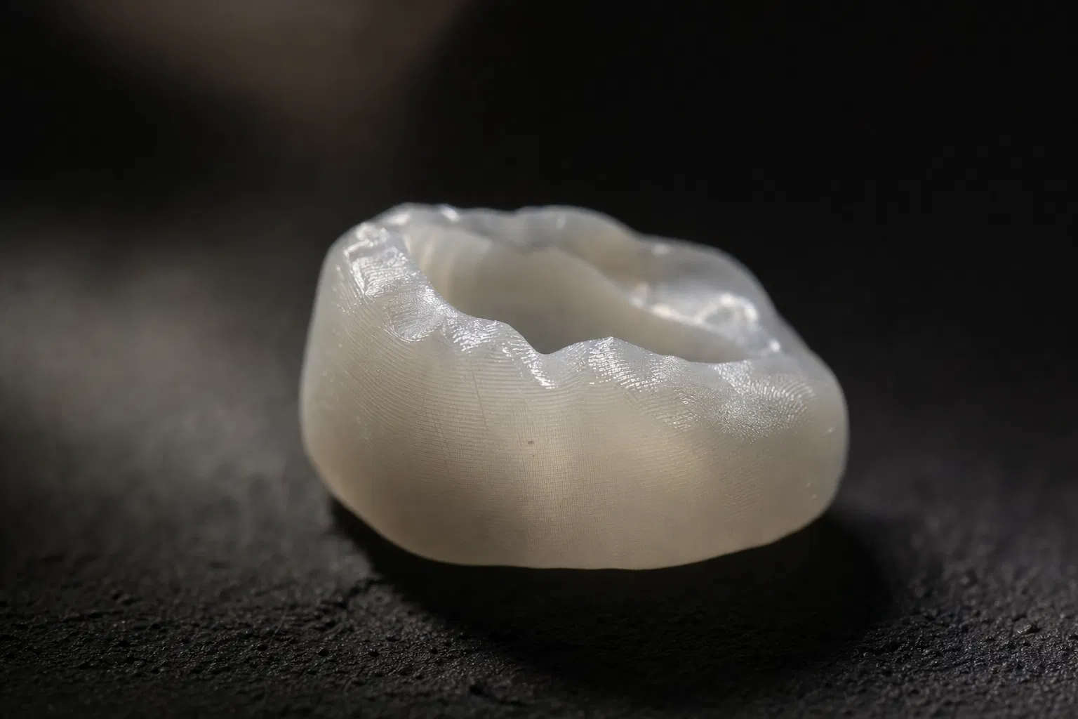 Orthodontic appliance precision fabrication