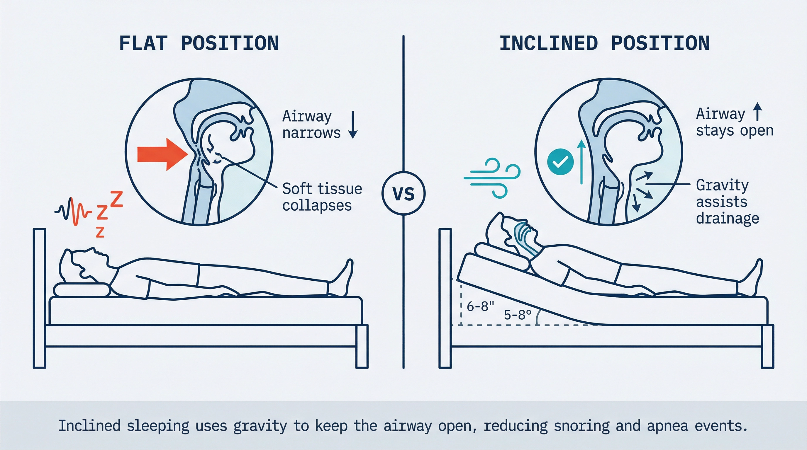 Side-by-side comparison: flat sleeping position shows a collapsed, narrowed airway and snoring; inclined position shows an open airway with gravity assisting drainage