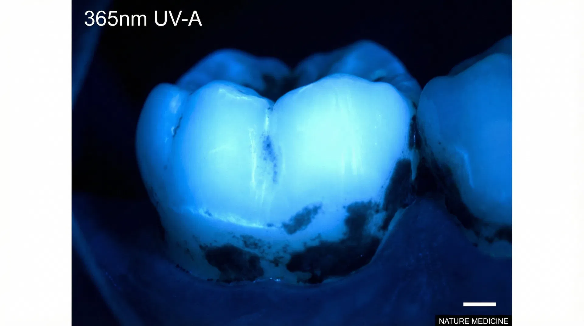 365nm structure mode