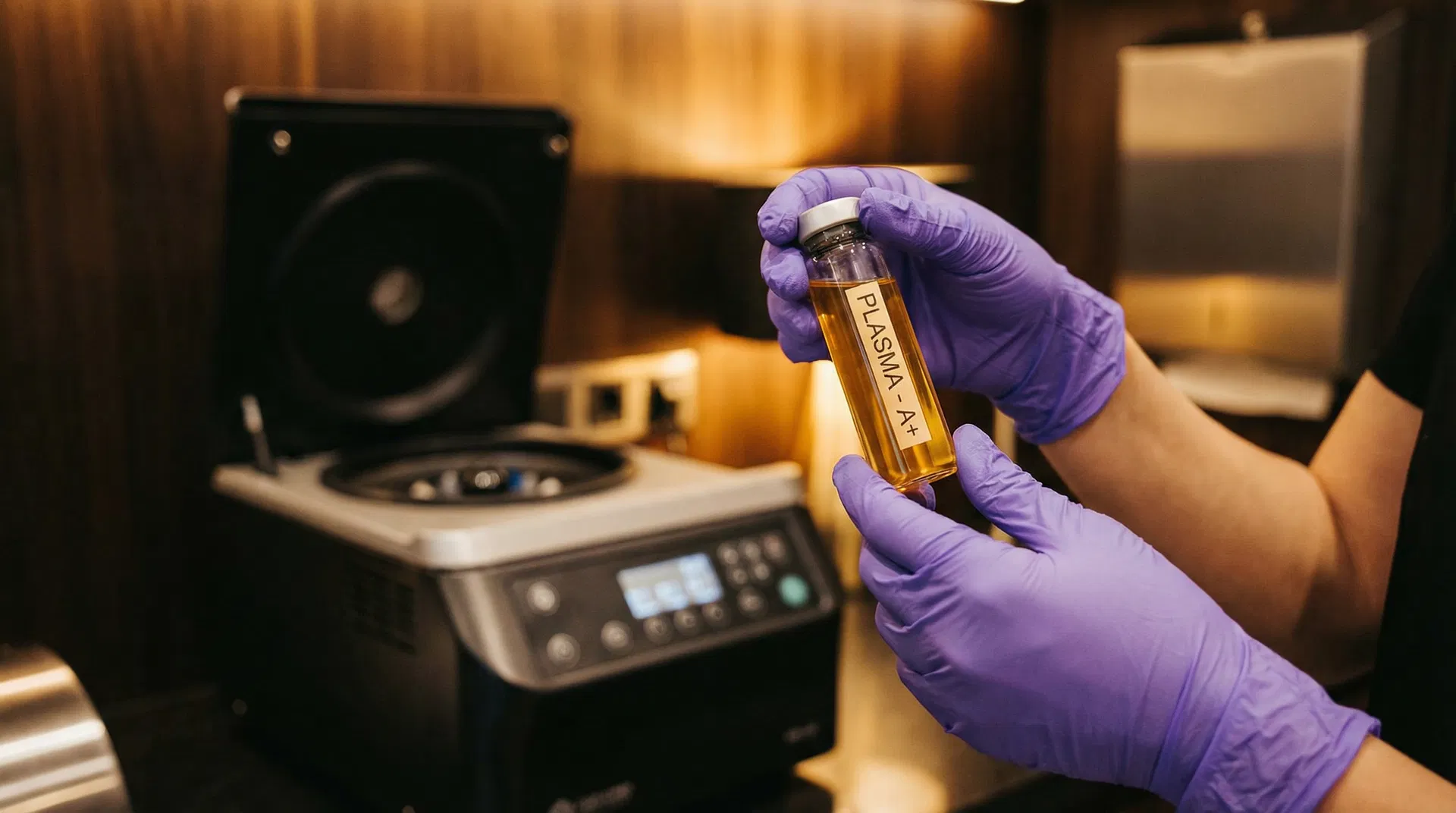 A vile of blood for a PRP PRF treatment Glasgow