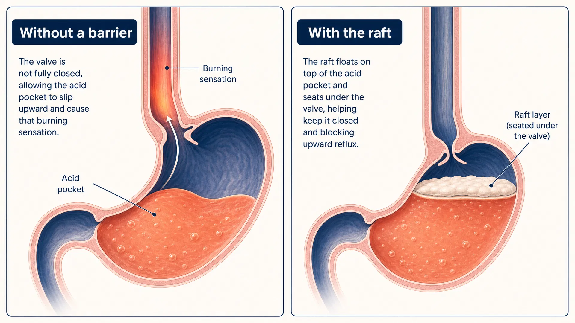 Comparison of valve without and with the raft barrier