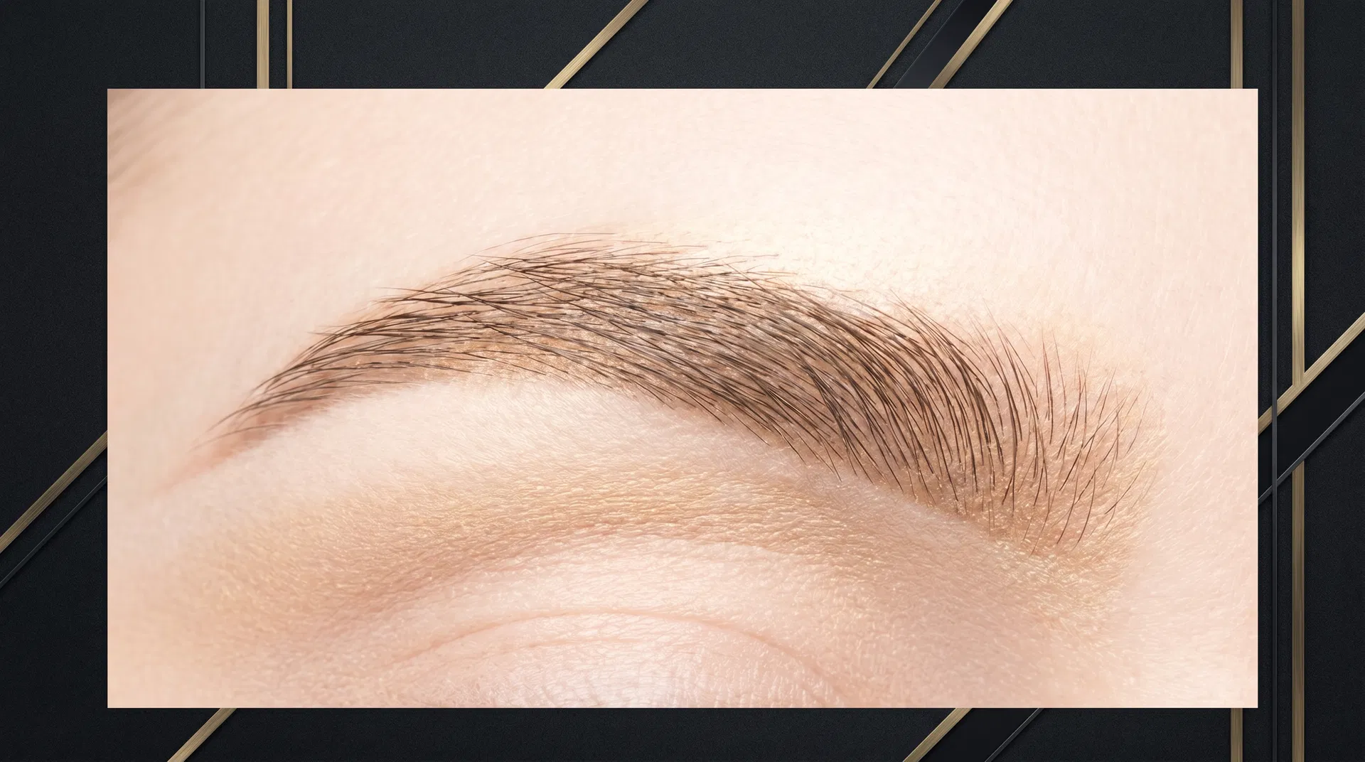 PMU Removal vs PMU Correction: Understanding Your Options for Unwanted Permanent Makeup