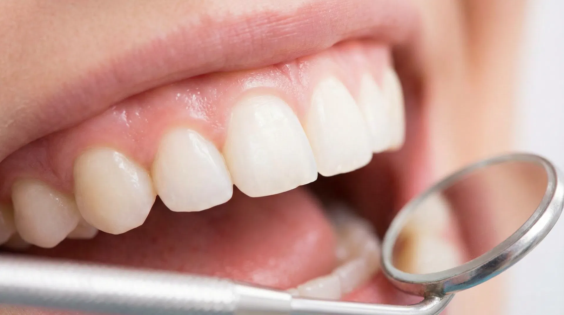 Hvordan behandles blottet tandhals effektivt?