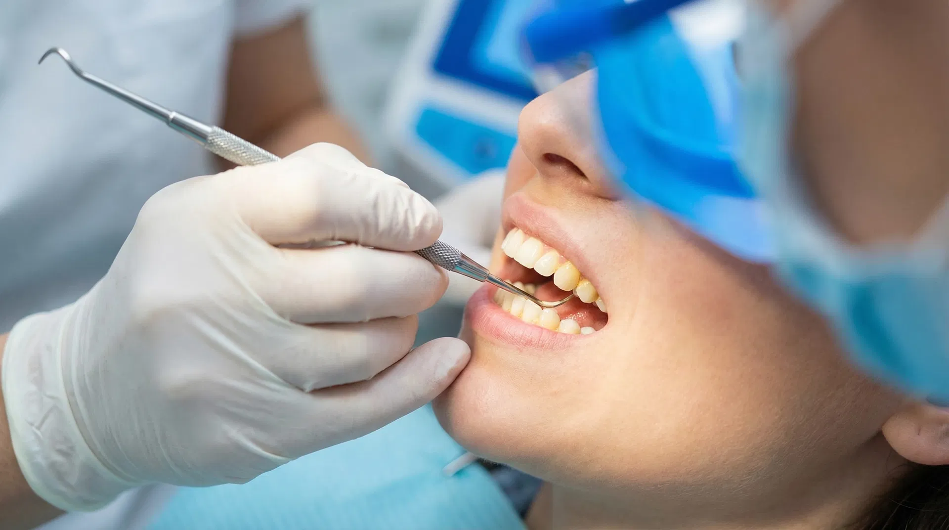 Plak på Tænderne: En Omfattende Guide til Forebyggelse og Behandling – illustration