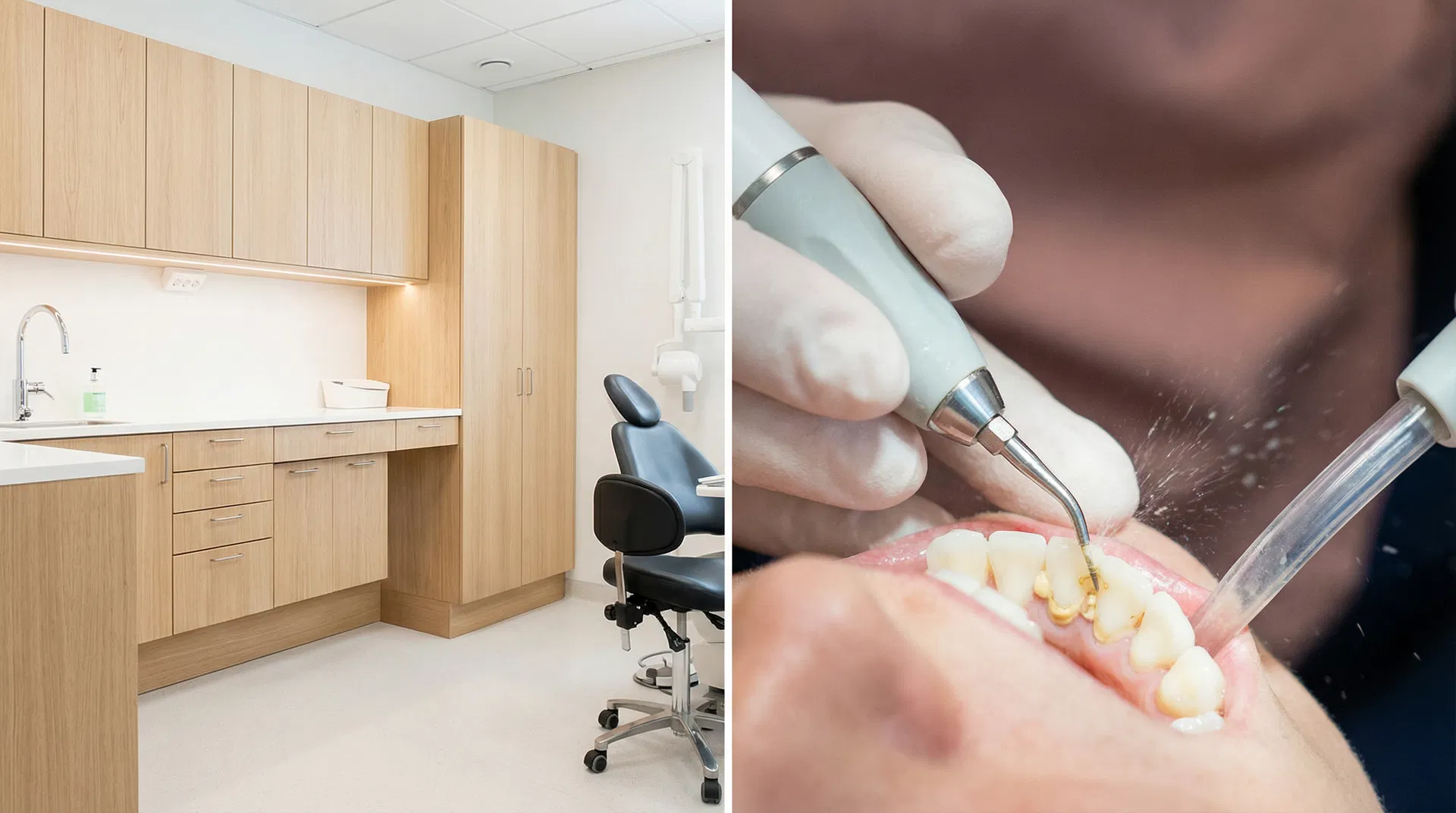 Tandsten: Forebyggelse og fjernelse – illustration