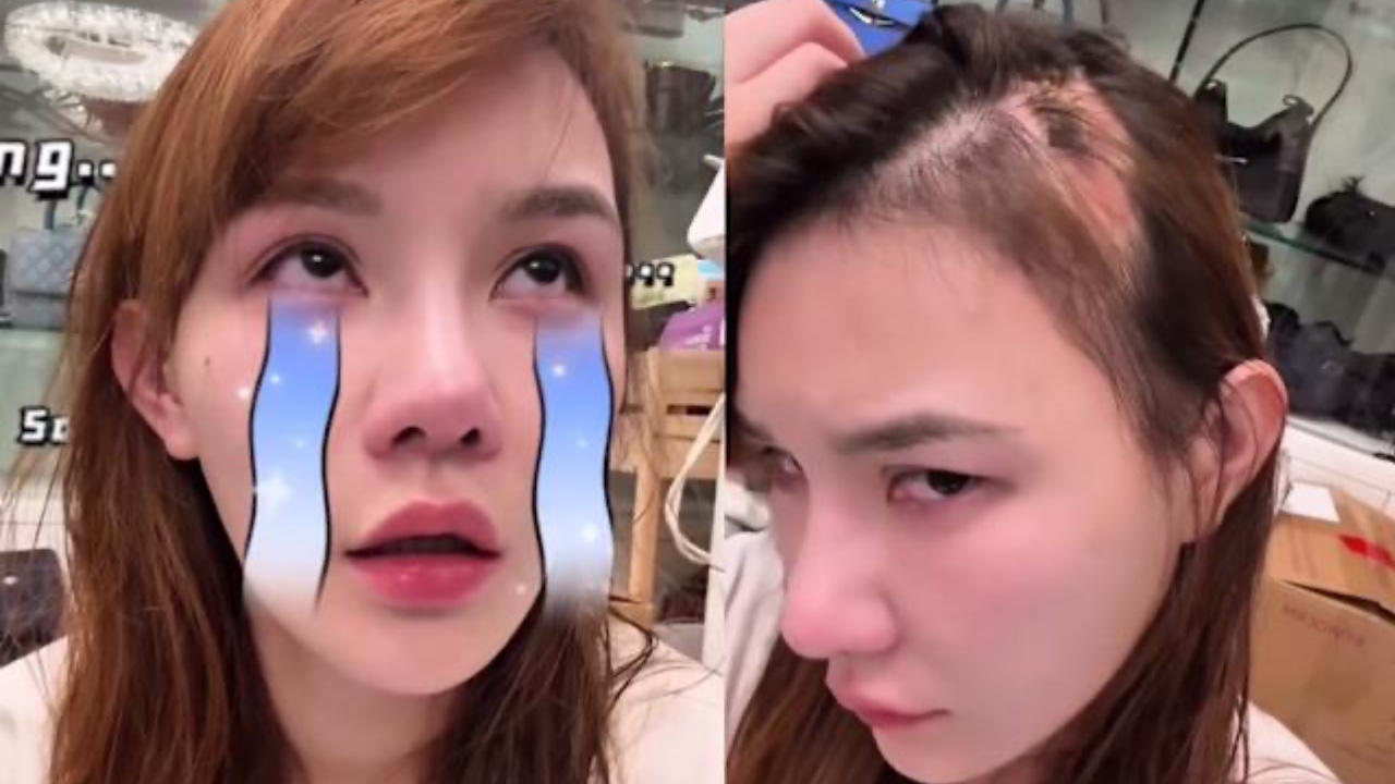 最強小三五索自揭整容真相！掀起假髮真實鬼剃頭情況任睇！