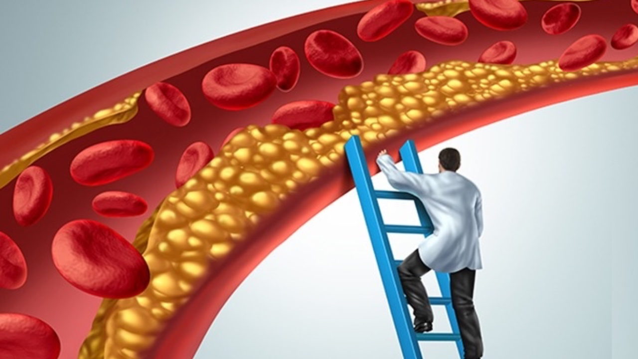 朝早起身手腳發麻?瞓極都攰?可能血管已經塞咗隨時中風!4大警號你要知!
