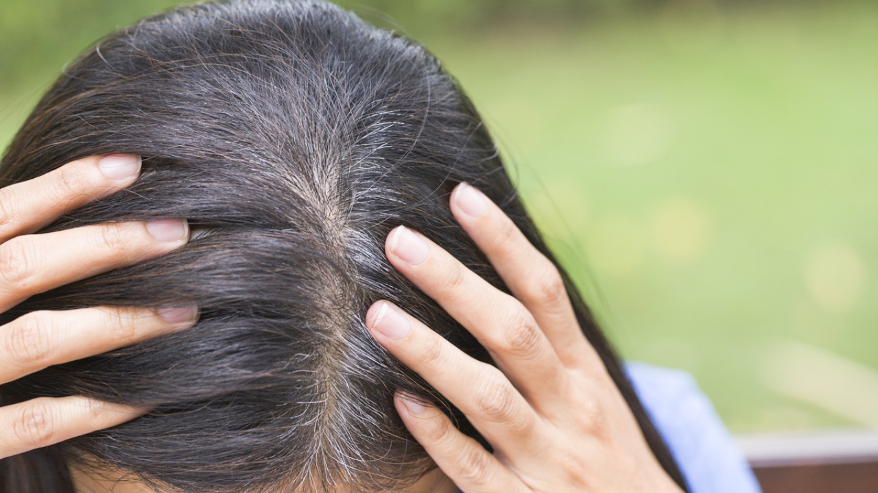 頭髮白咗唔一定係老,係健康警號?真正元兇可能一直係你生活入面!