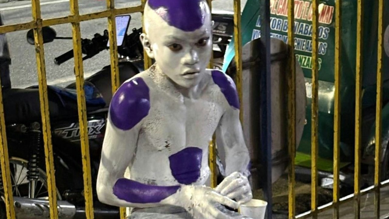 Cosplay翻車第一名】男童被阿媽油乳膠漆，變「真菲利」！洗足一星期都洗唔甩，分分鐘入ICU！