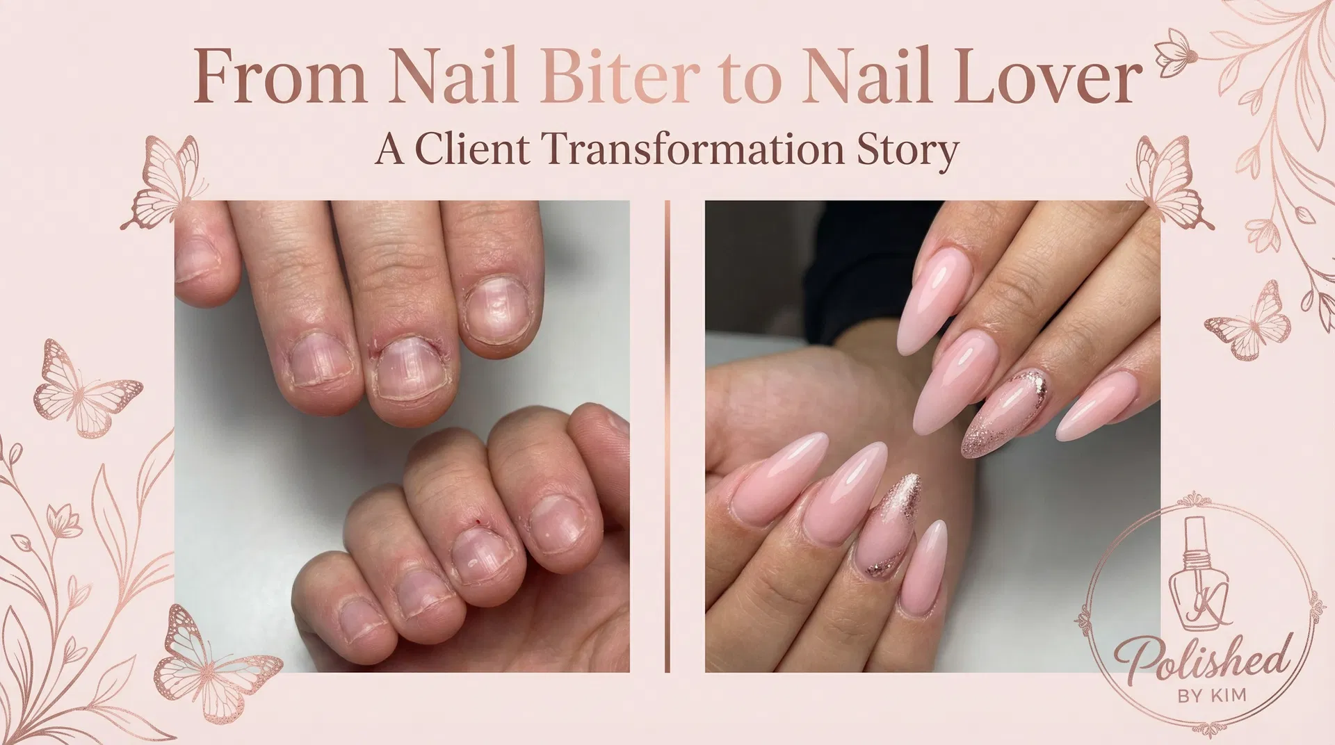 From Nail Biter to Nail Lover: A Client Transformation Story