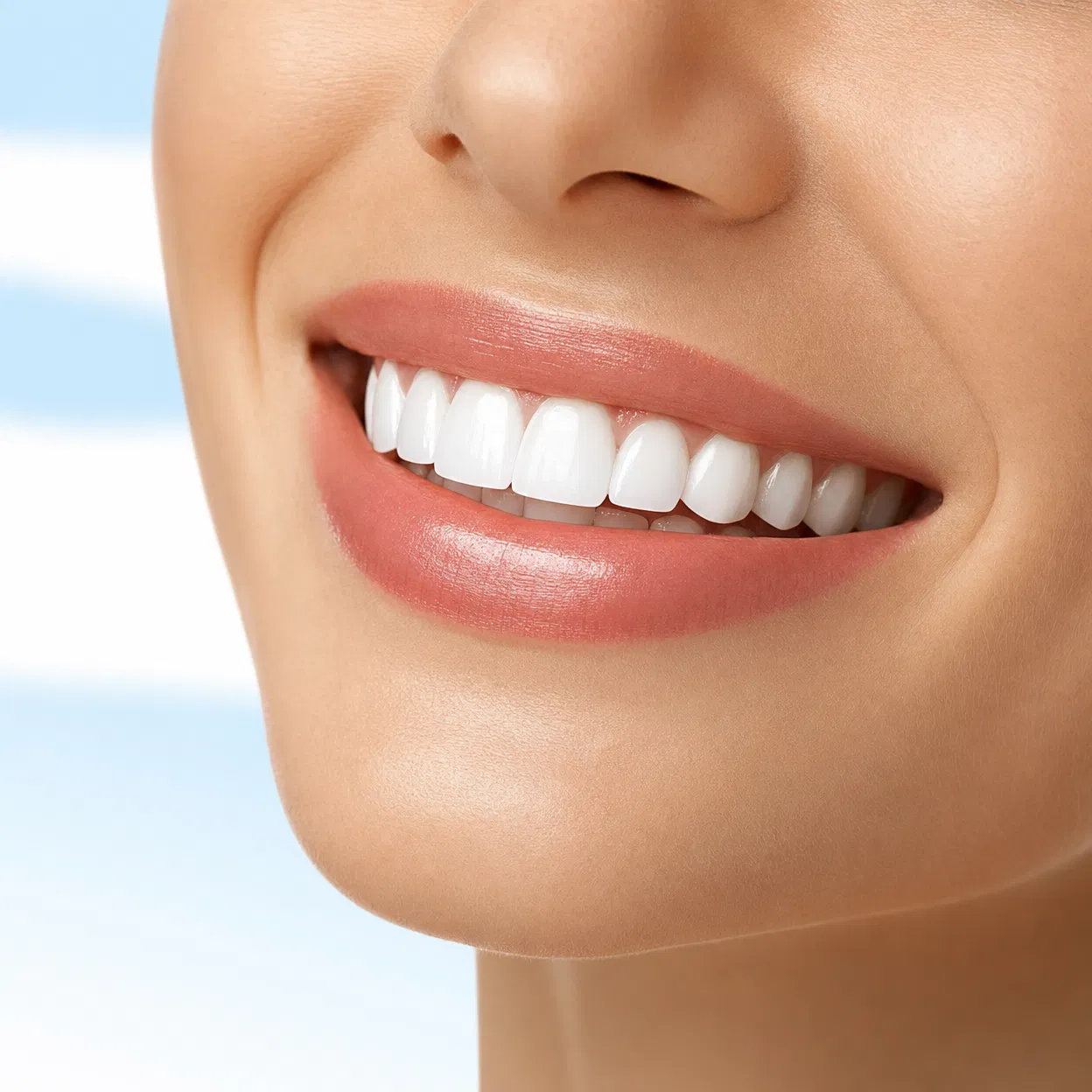 Veneers