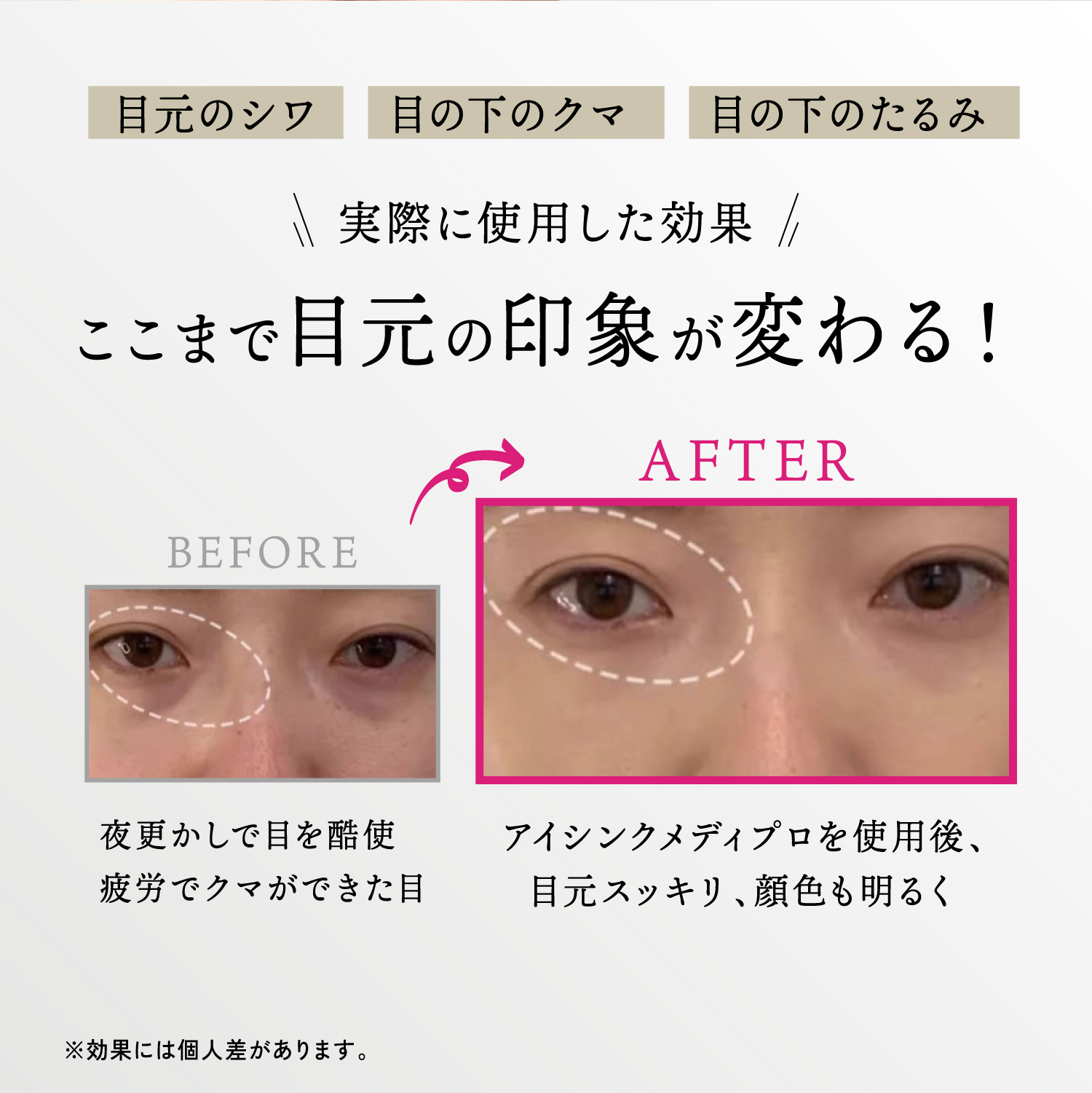 KYOGOKU アイシンク 目元美顔器