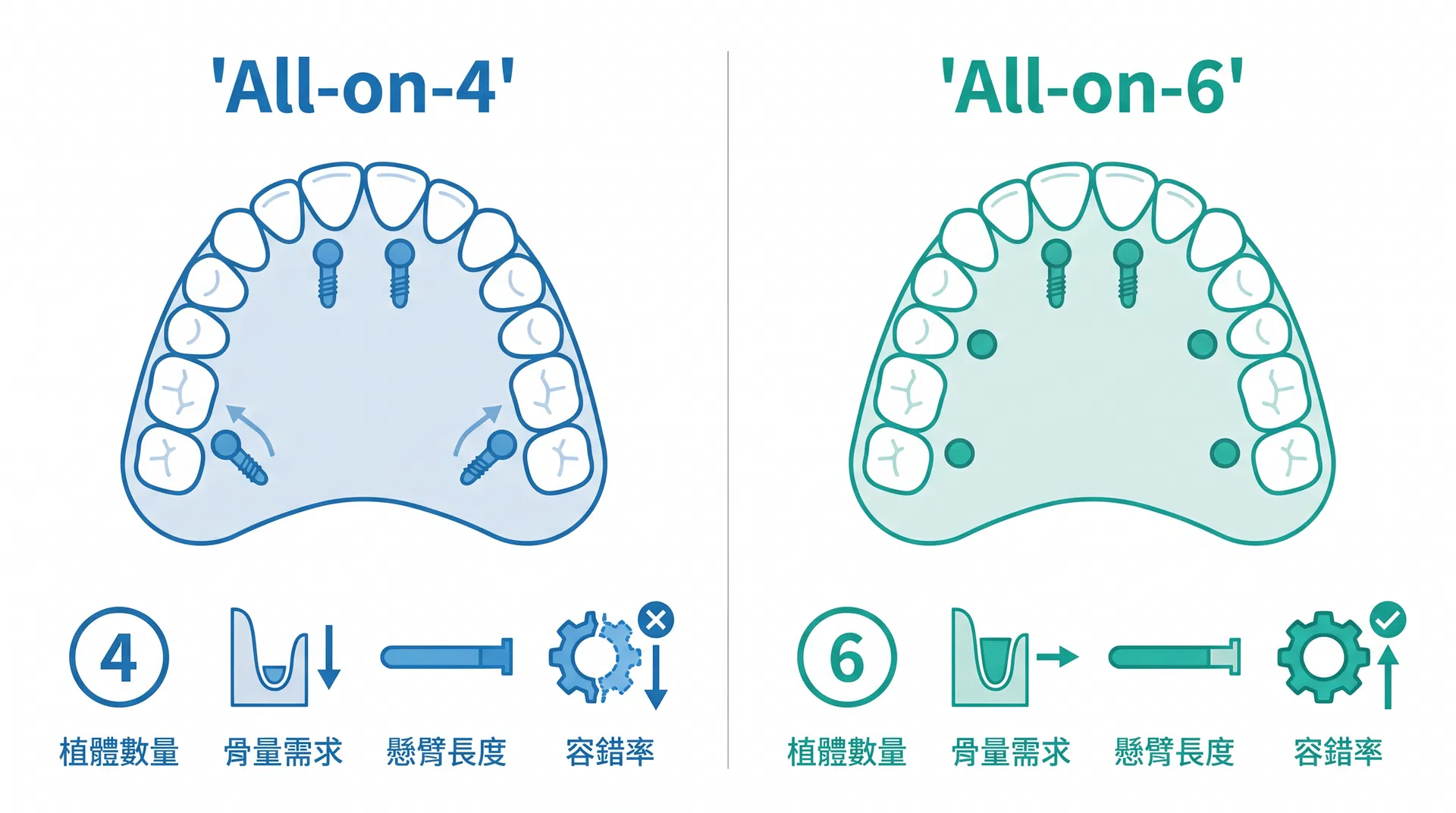 All-on-4 與 All-on-6 植體配置比較資訊圖表