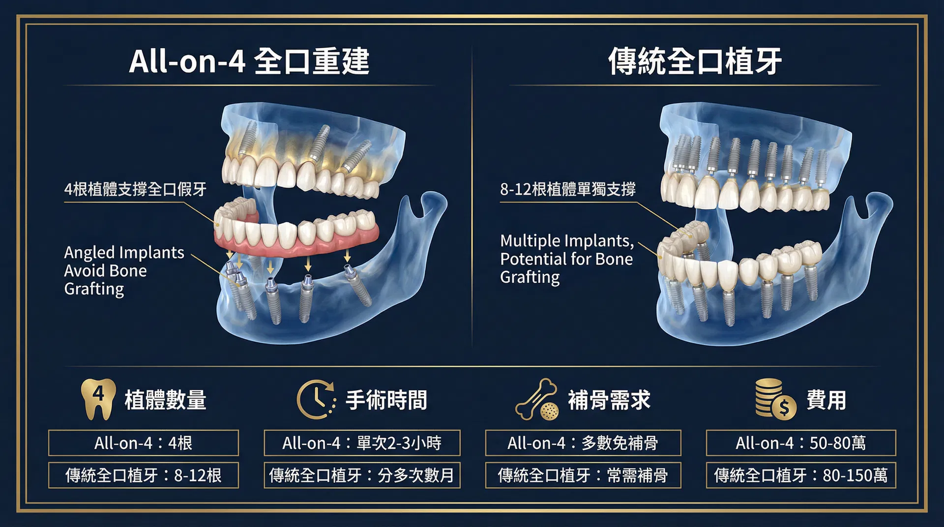 All-on-4 全口重建 vs 傳統全口植牙比較資訊圖表