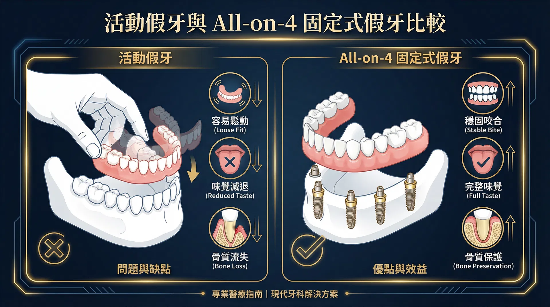 活動假牙與 All-on-4 固定式假牙比較資訊圖表