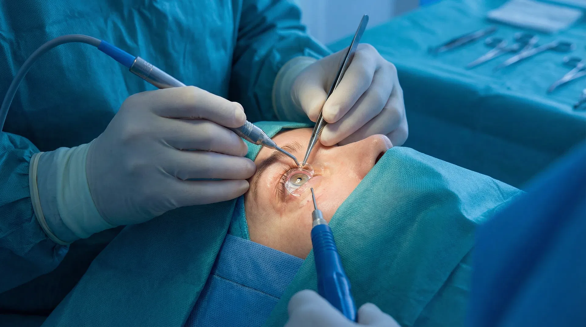 Cataract Surgery