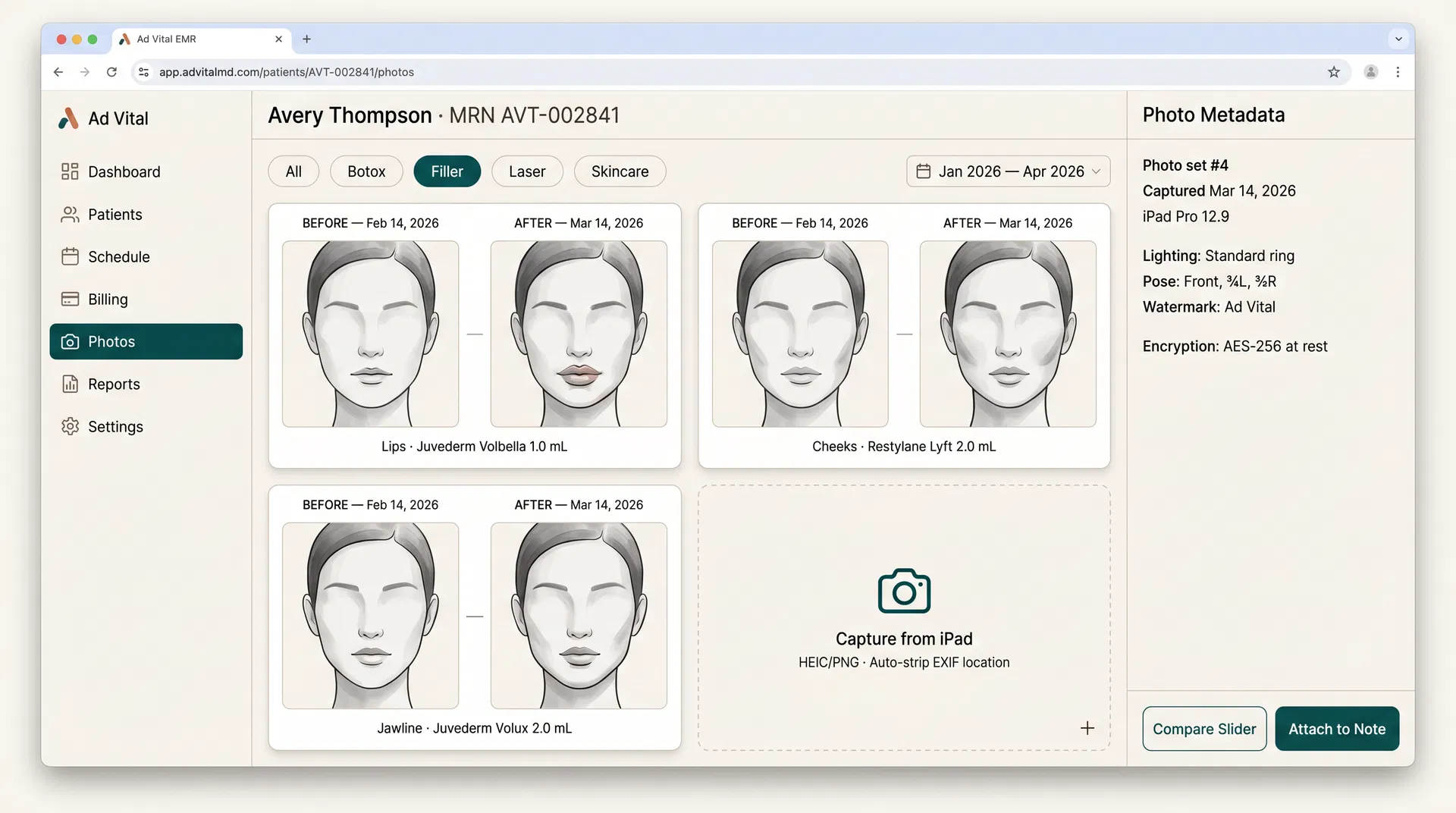 Ad Vital AI EMR before/after treatment photo management with side-by-side comparison for med spa