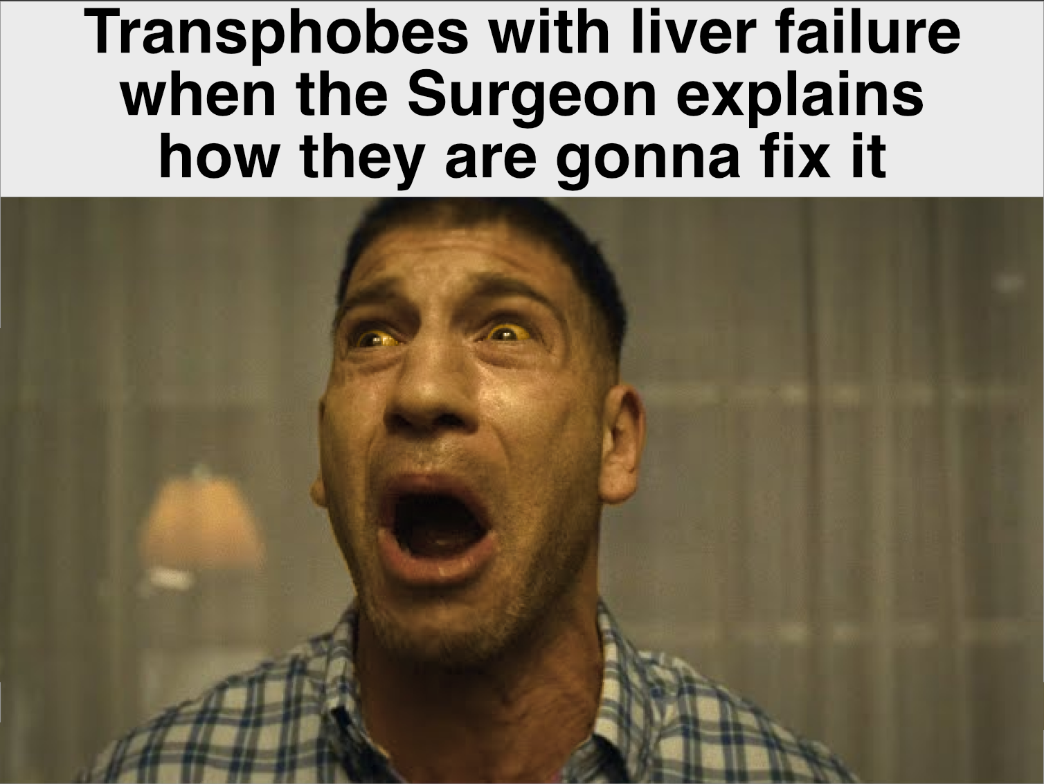 they only want cisplants