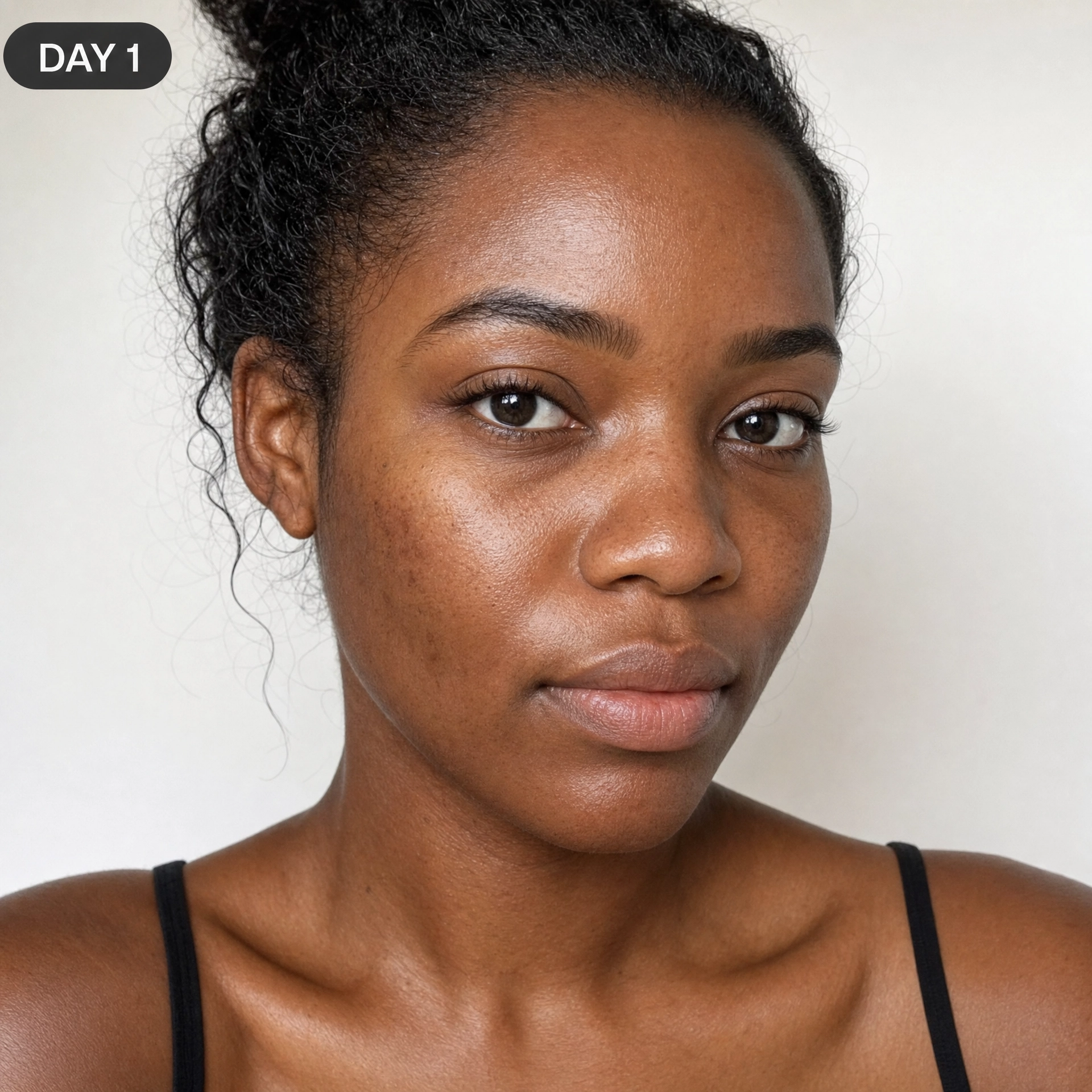 Day 1 skin