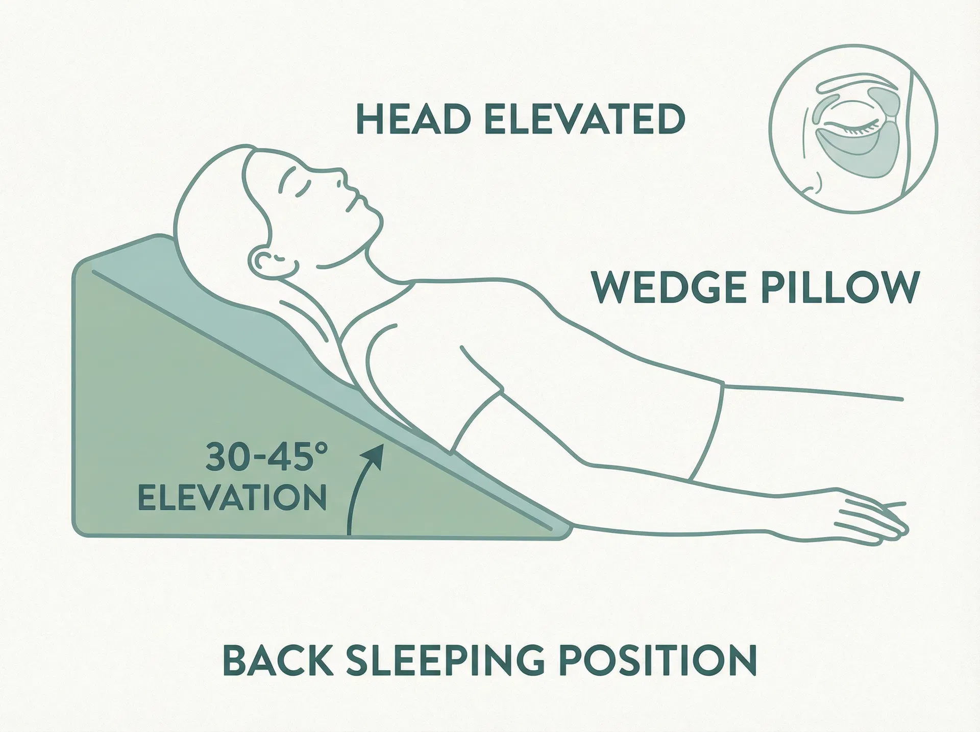 Proper sleep positioning after eyelid surgery