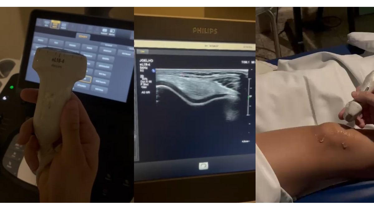Montagem com transdutor de ultrassom, imagem do exame no monitor e joelho de paciente sendo examinado