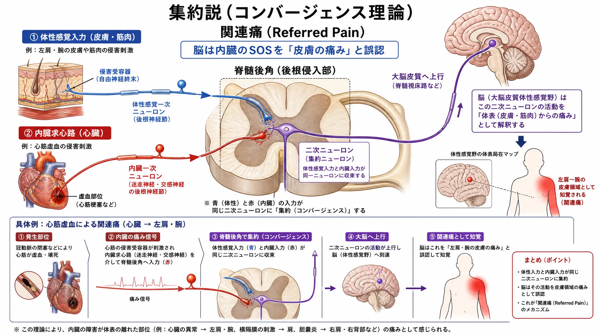 集約説（コンバージェンス理論）と関連痛：内臓求心路と体性感覚入力が脊髄後角の同一ニューロンに収束し、脳が痛みの発生源を誤認するメカニズム