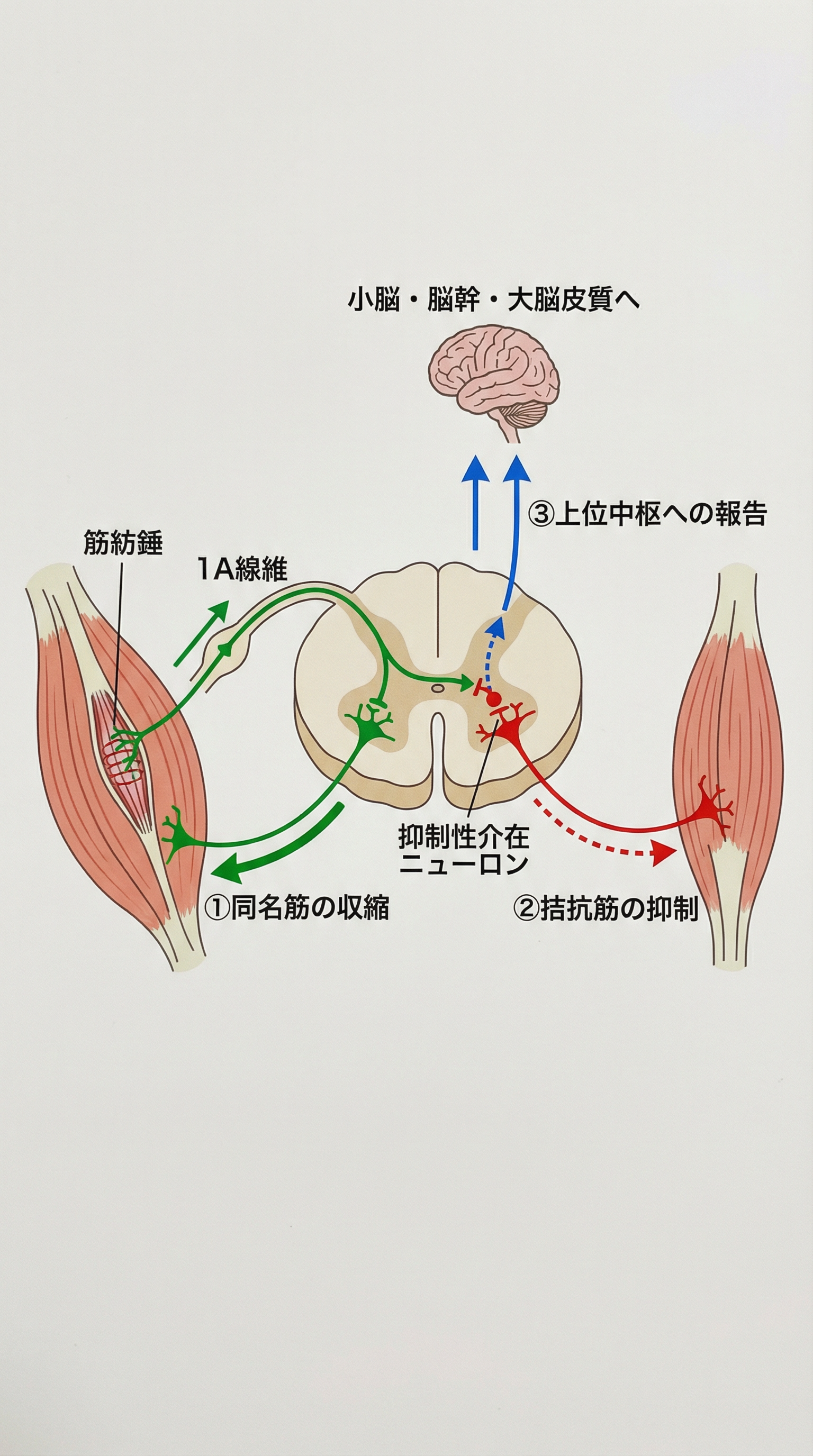 図2: 1A線維を介した反射の三層（同名筋収縮・拮抗筋抑制・上位中枢報告）
