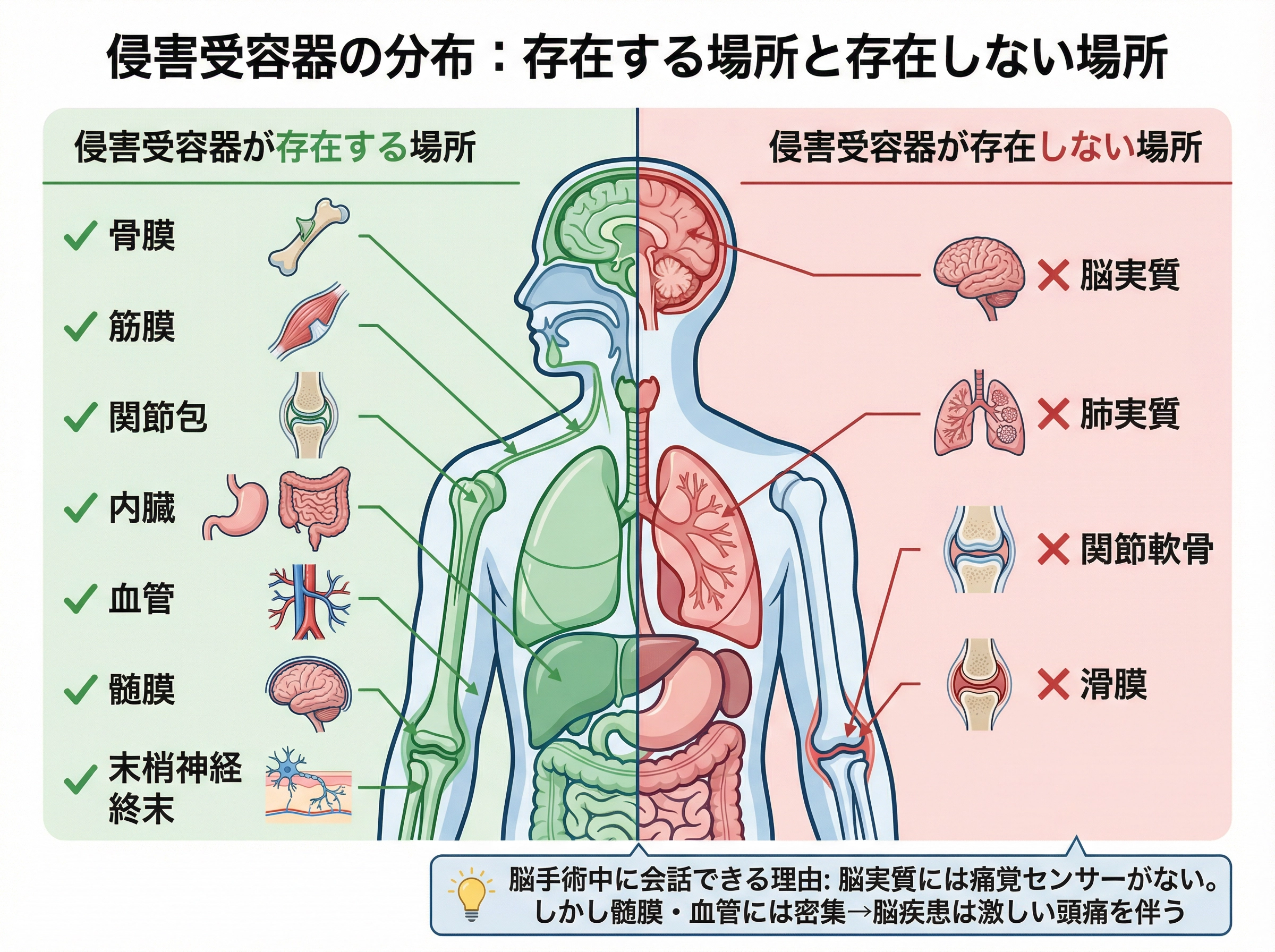 脳実質には痛覚センサーがないため開頭手術中も会話が可能。しかし髄膜・血管には密集しているため脳疾患は激しい頭痛を伴う。