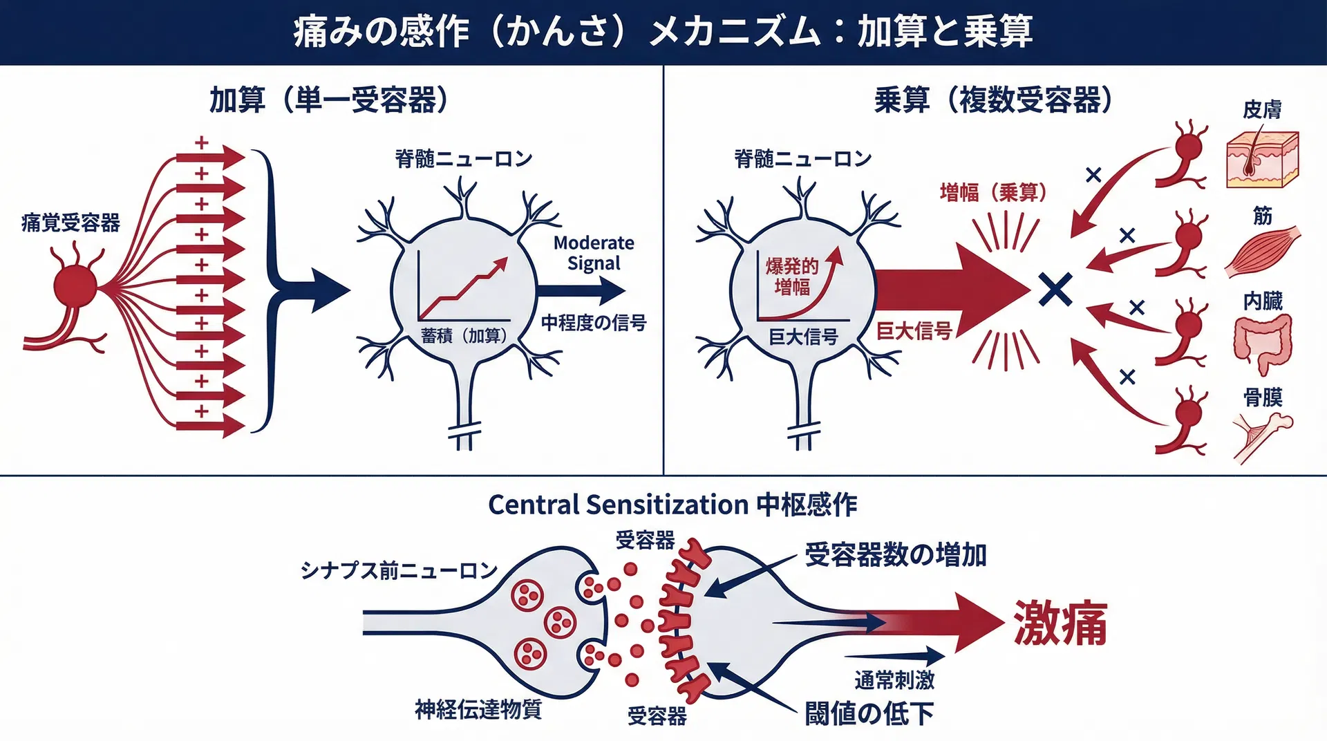 痛みの感作（かんさ）メカニズム：加算と乗算
