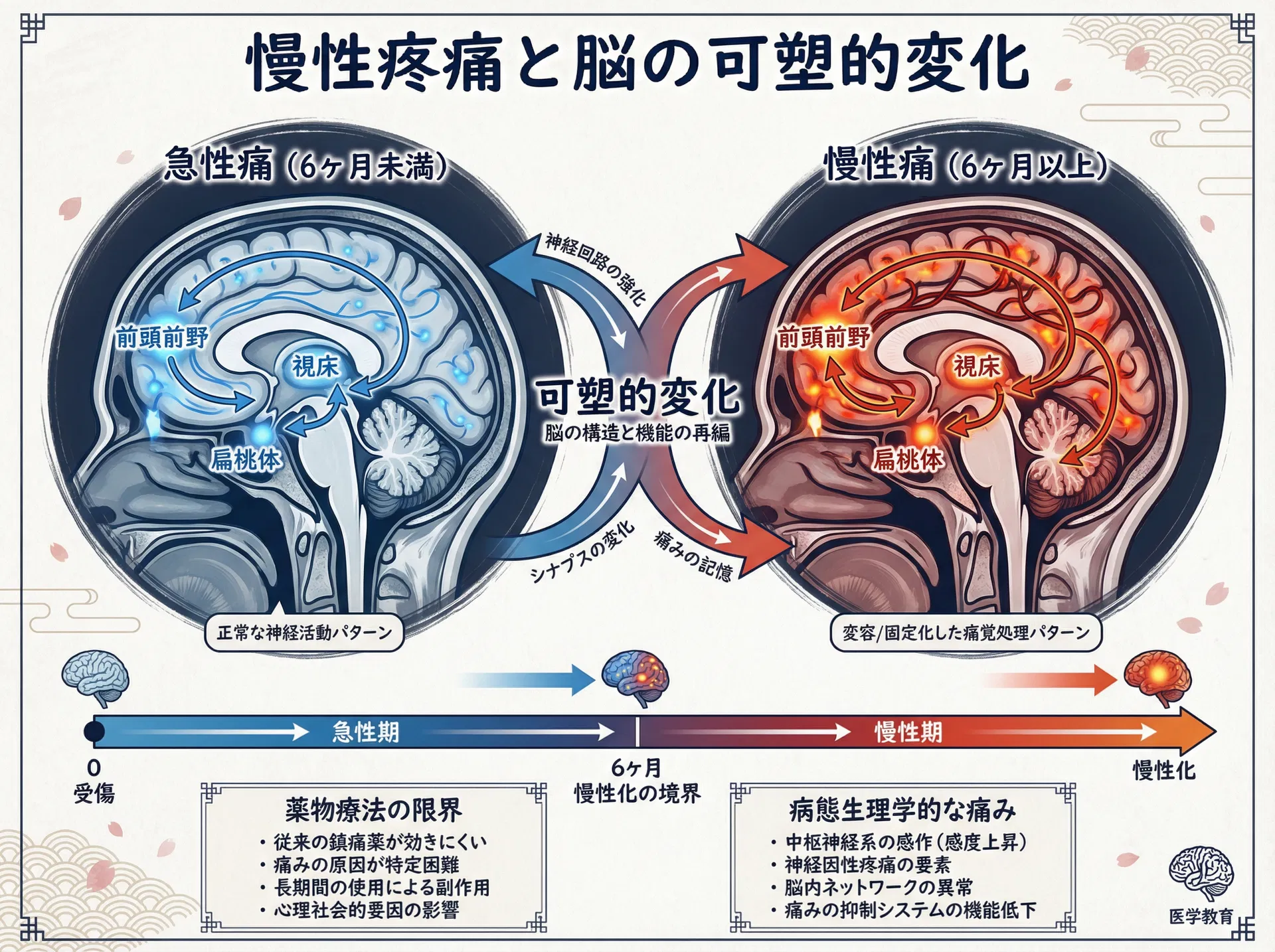 慢性疼痛と脳の可塑的変化
