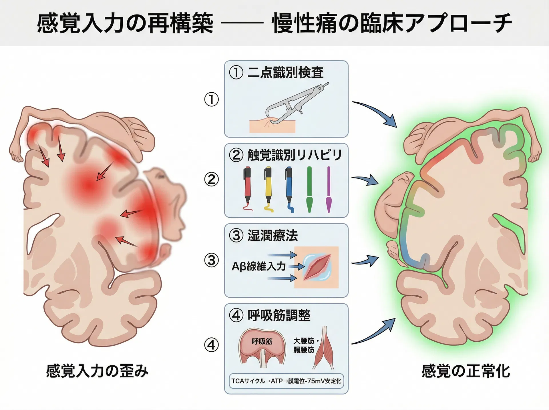 感覚入力の再構築 ―― 慢性痛の臨床アプローチ
