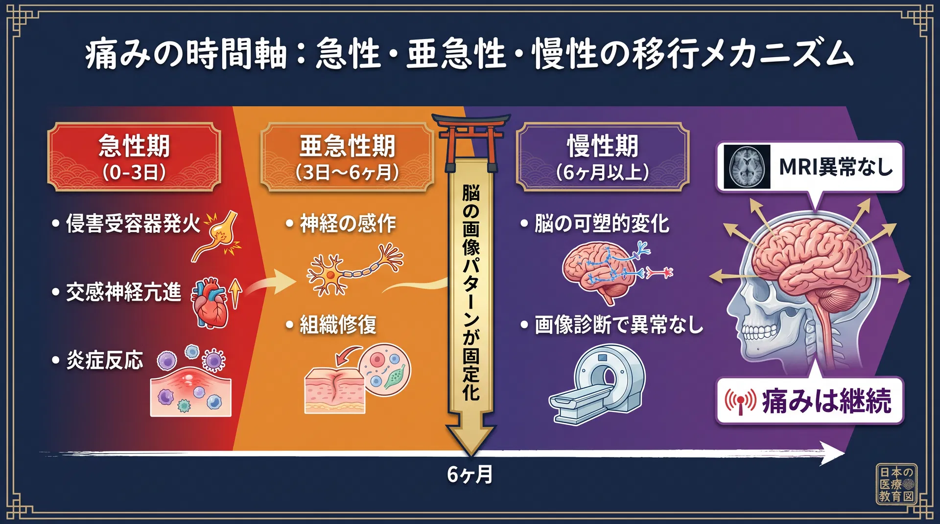 痛みの時間軸：急性・亜急性・慢性の移行メカニズム