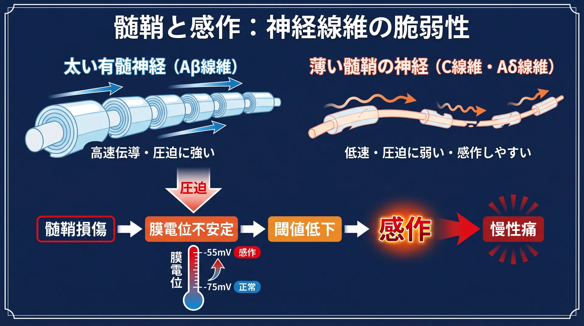 髄鞘と感作：神経線維の脆弱性