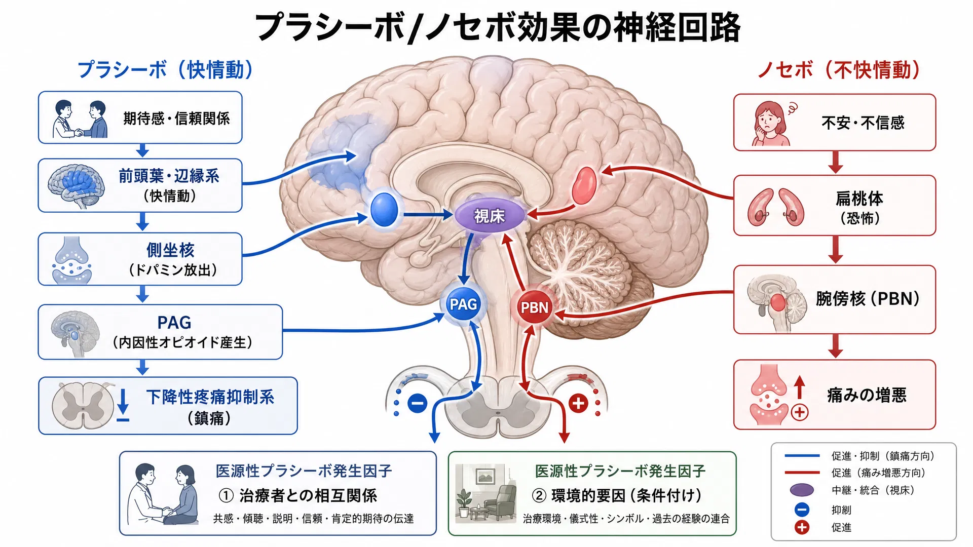 プラシーボ/ノセボ効果の神経回路 ―― 期待感・信頼関係が前頭葉・辺縁系を活性化し、側坐核→PAG→下降性疼痛抑制系を駆動する経路と、不安・不信感がノセボ（痛み増悪）を引き起こす経路の対比図
