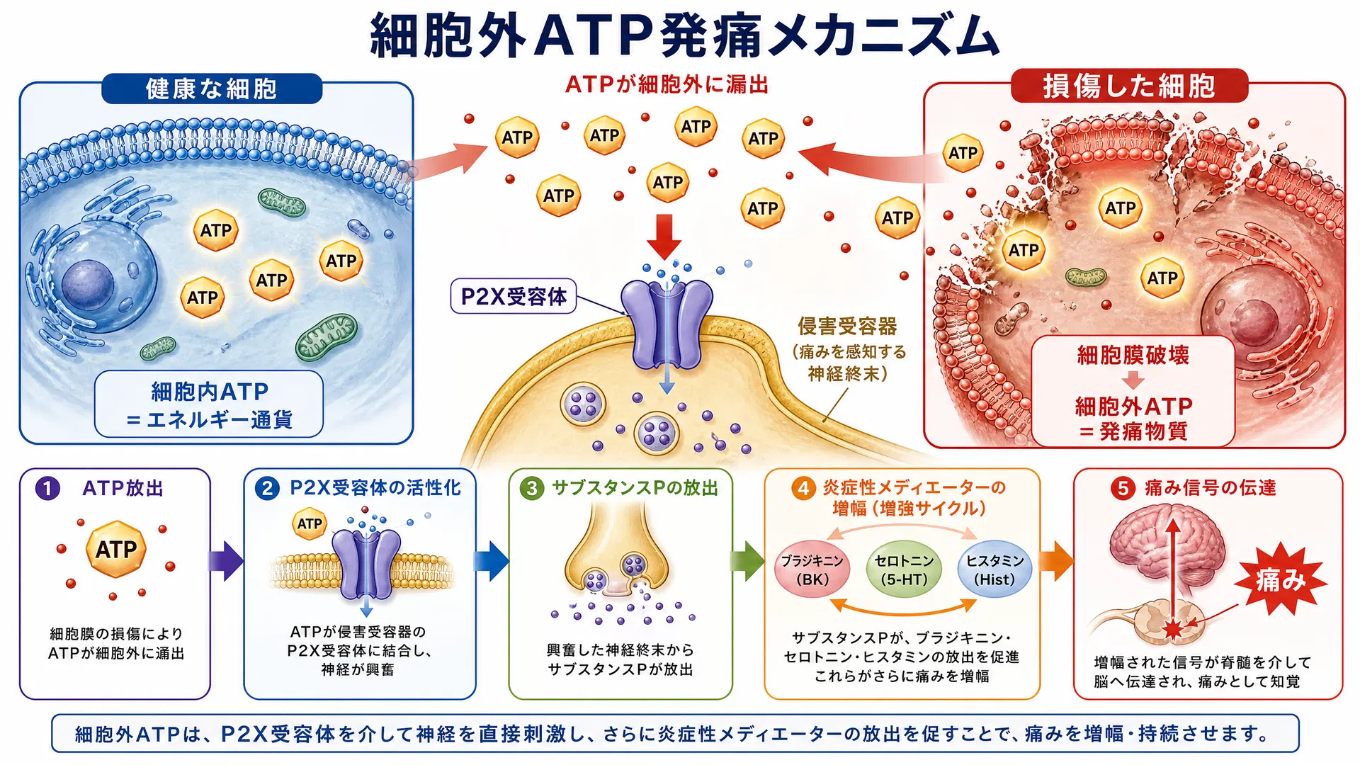 細胞外ATP発痛メカニズム：細胞膜破壊→ATP漏出→P2X受容体活性化→炎症性メディエーター増幅の5ステップ連鎖図