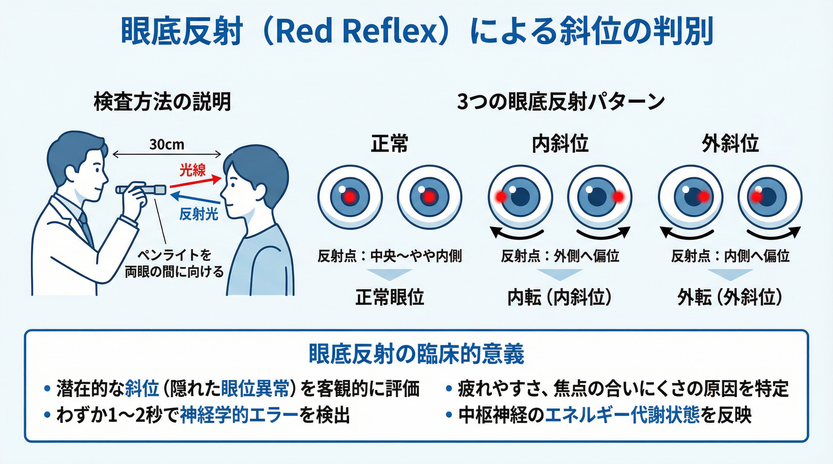 眼底反射（Red Reflex）による斜位の判別