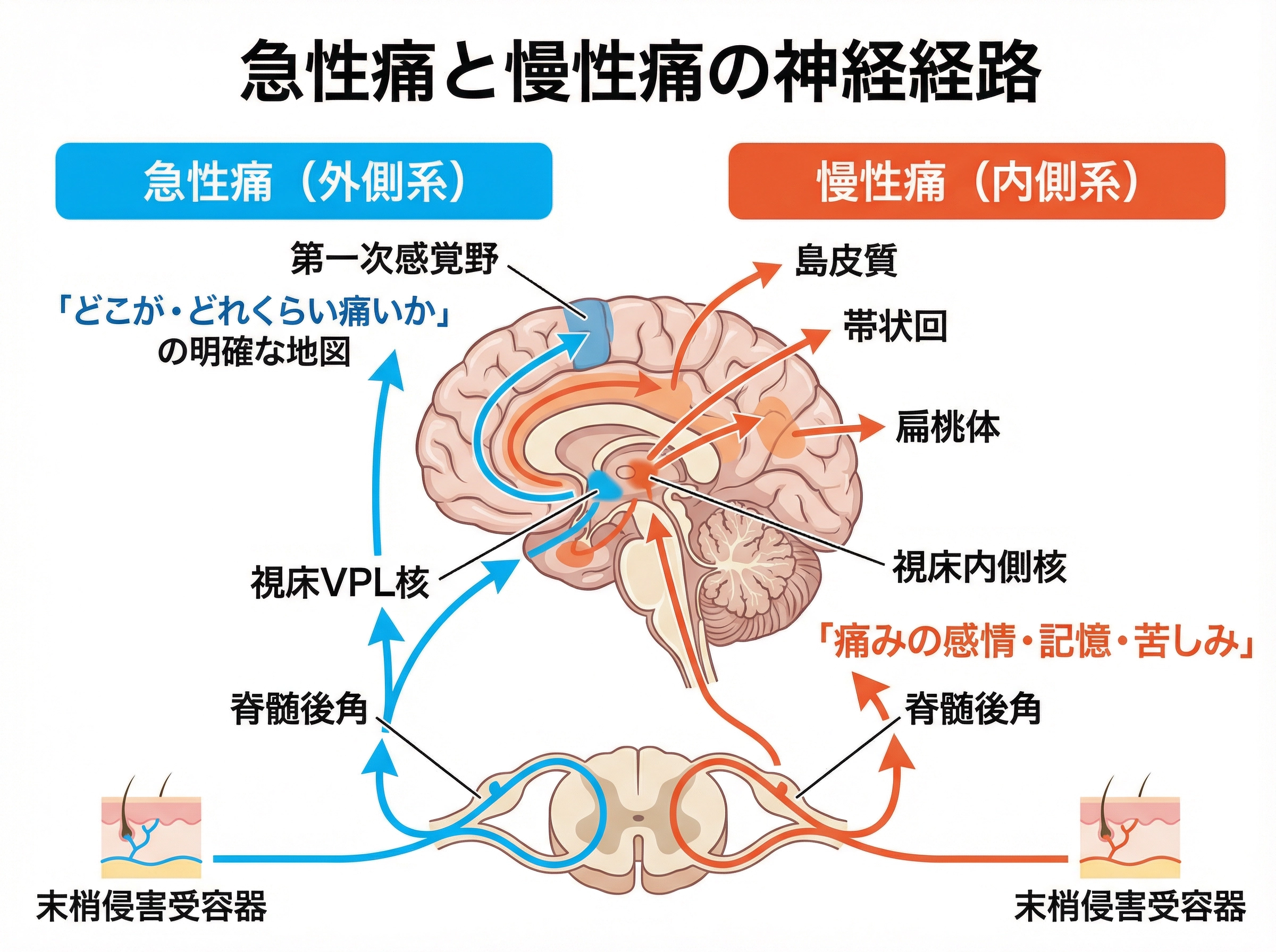 急性痛と慢性痛の神経経路
