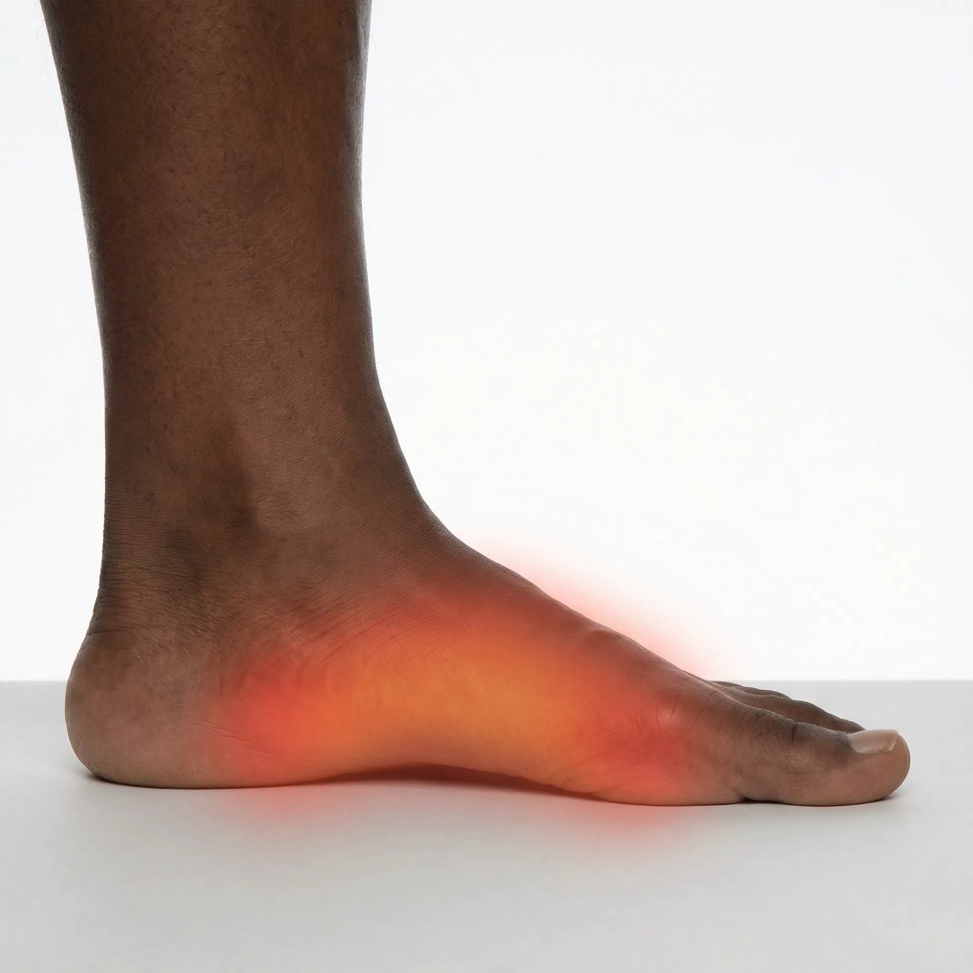 Plantar Fasciitis