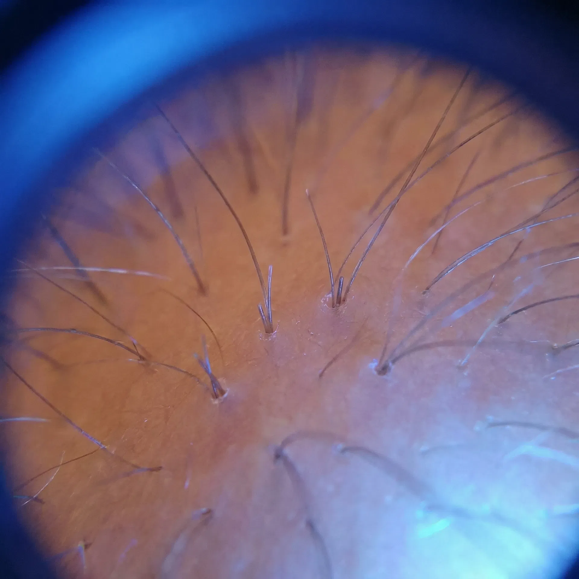 Stop Thinning at the Source