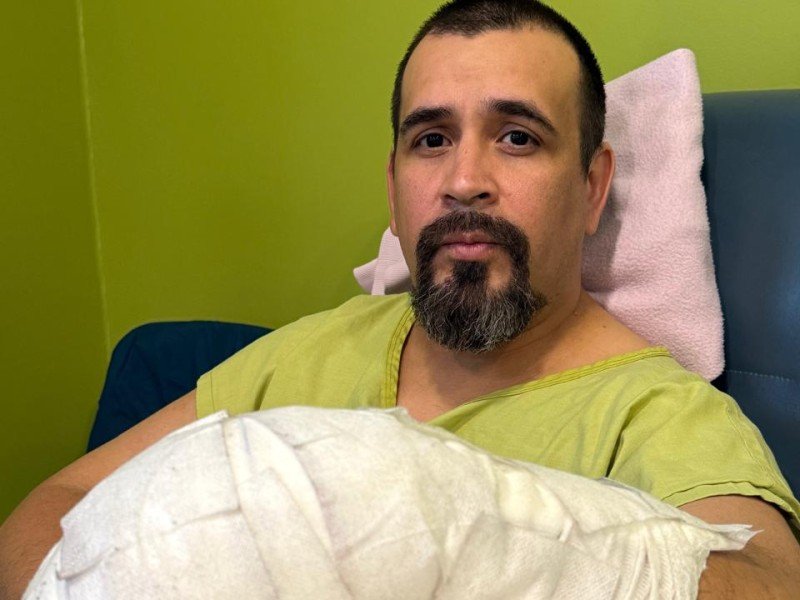 Exitosa cirugía en Hospital Puerto Montt: Salvan mano de joven tras grave accidente laboral