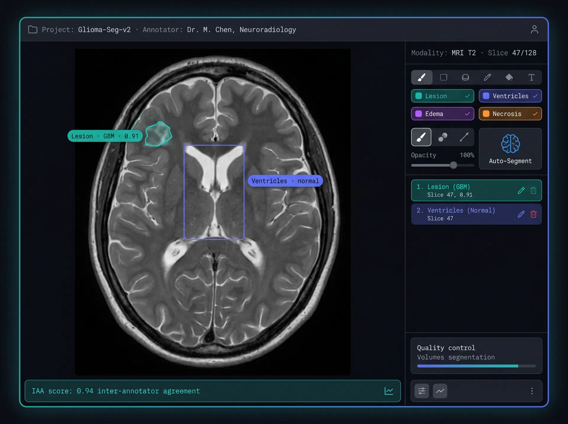 Clinical Data Annotation