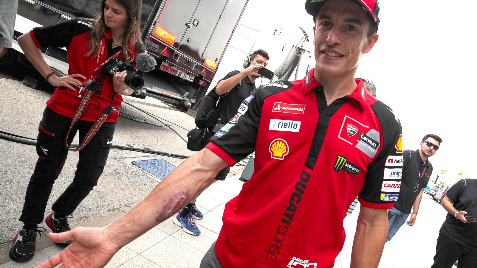 Marquez Displays COTA Injury Ahead of Spanish MotoGP