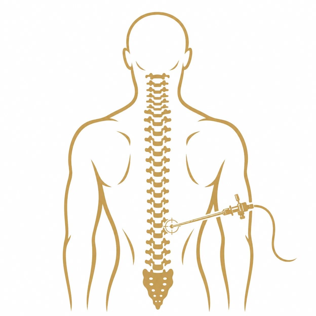 Cirurgia Minimamente Invasiva