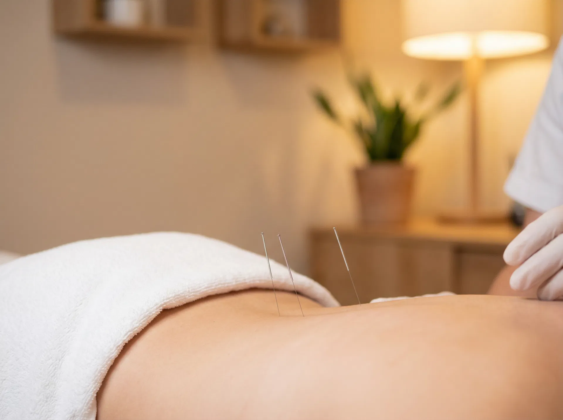 Acupuncture