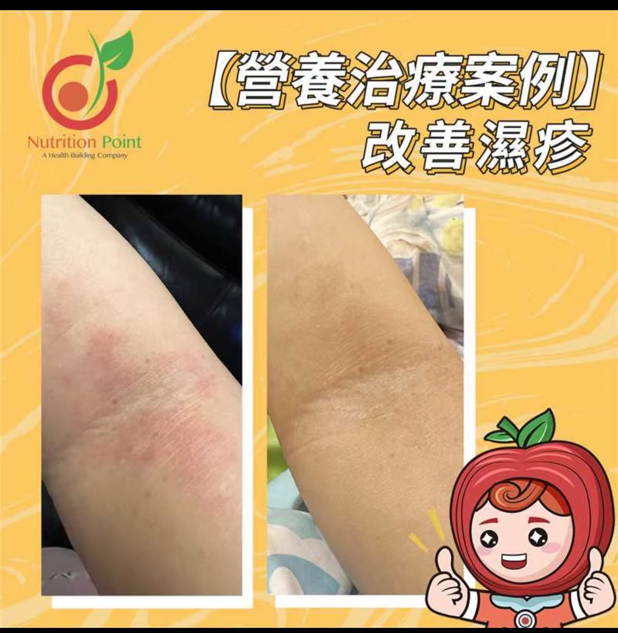 Nutricera-3 濕疹清 4