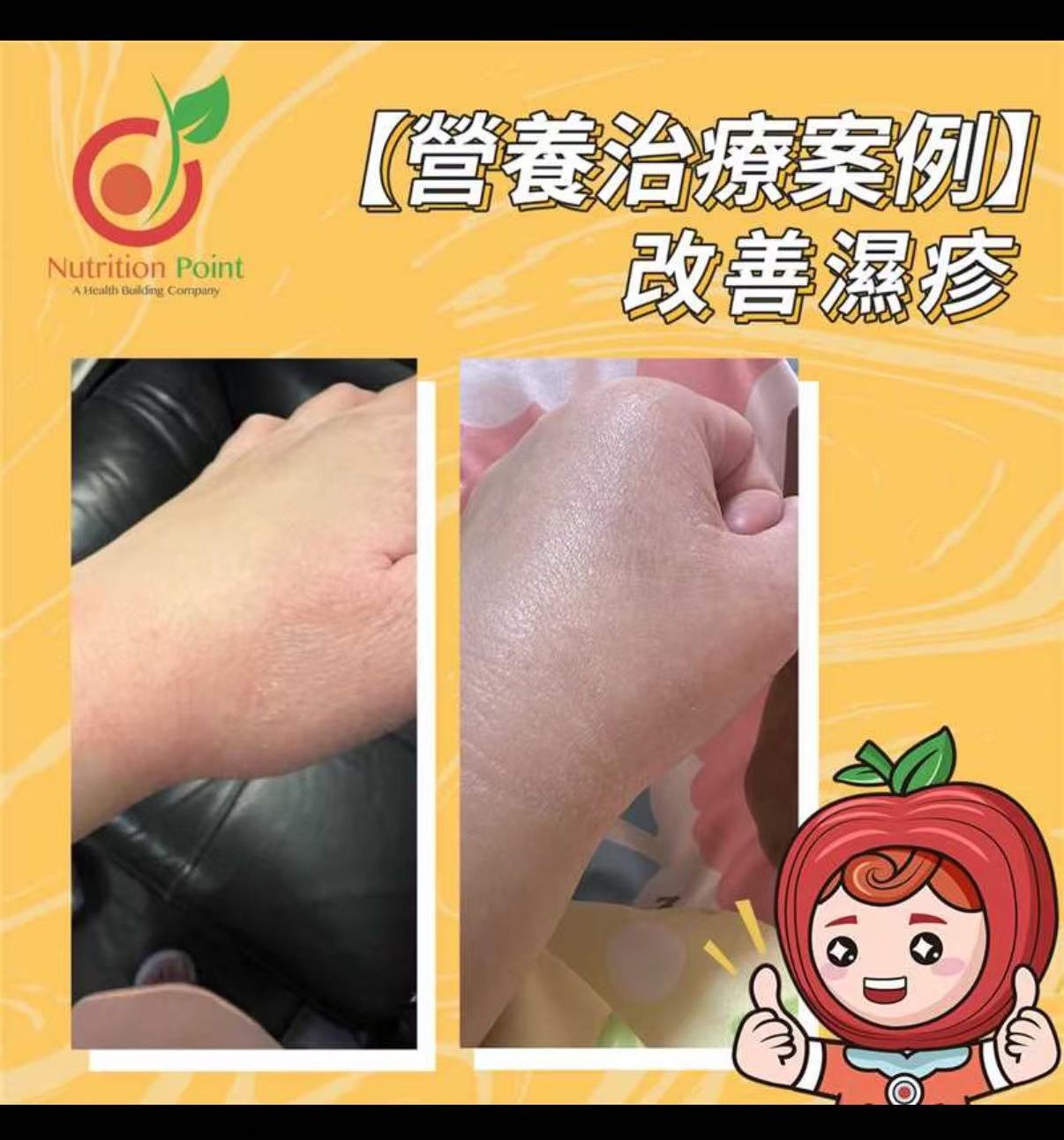 Nutricera-3 濕疹清 5