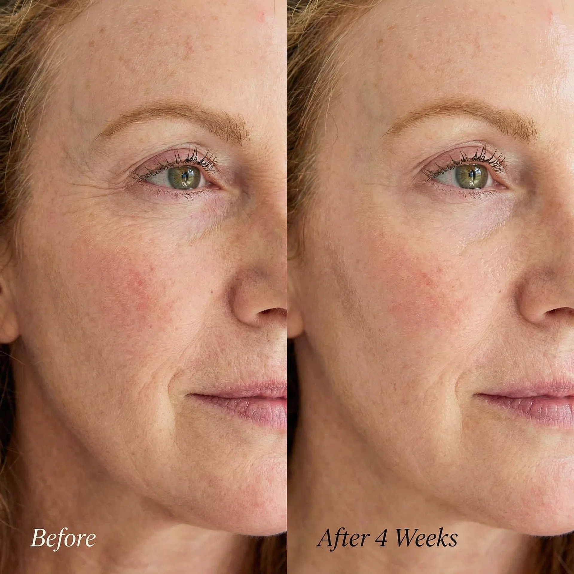 Before and after 4 weeks