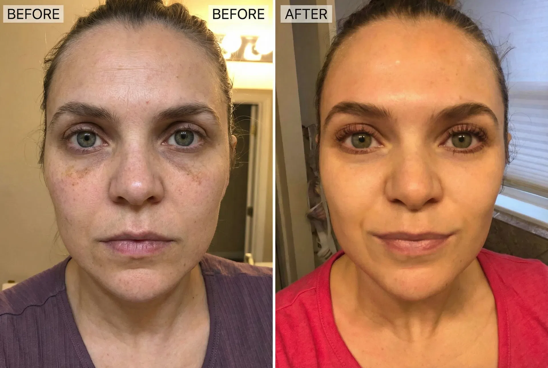 Real customer before and after using Veloura PDRN Collagen Jelly Mask