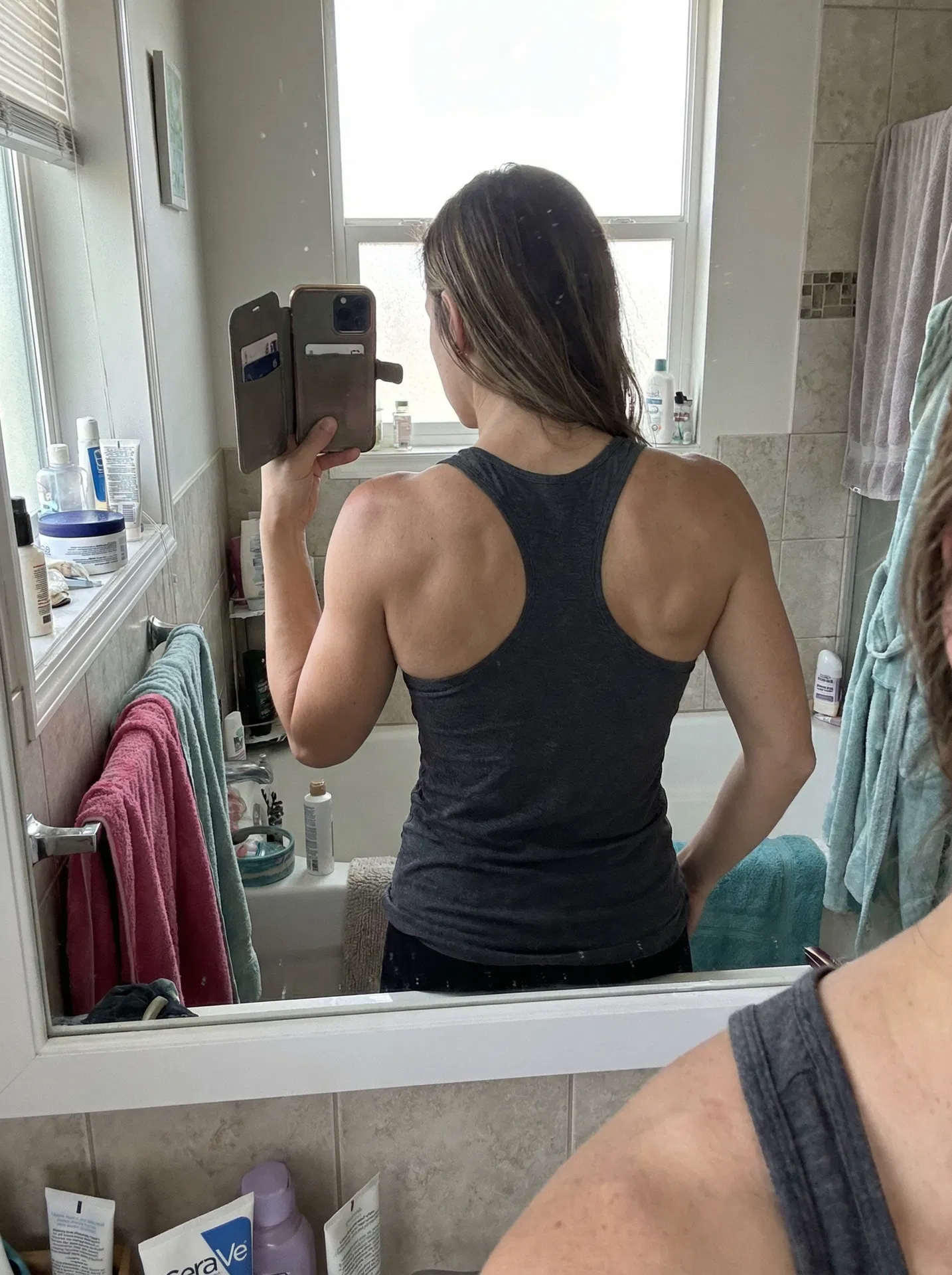 Before - Posture & pain recovery