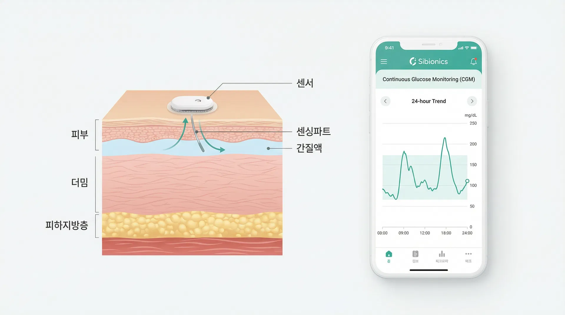연속혈당측정시스템 설명